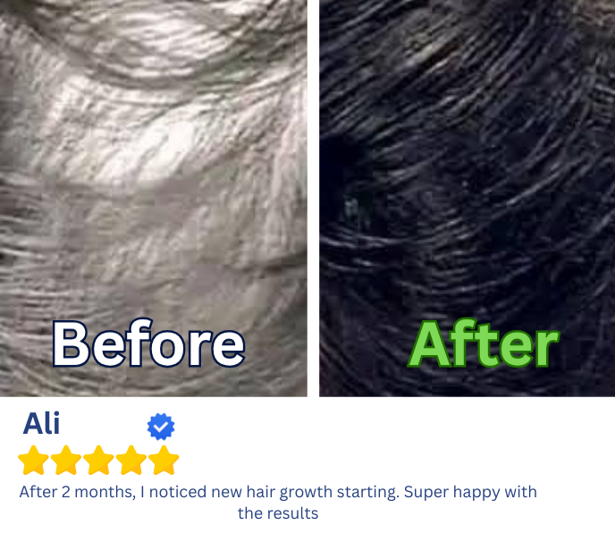 JAMAL UL LISHABAB HAIR GROWTH KIT