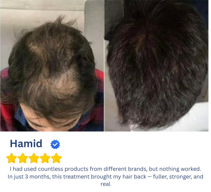 JAMAL UL LISHABAB HAIR GROWTH KIT