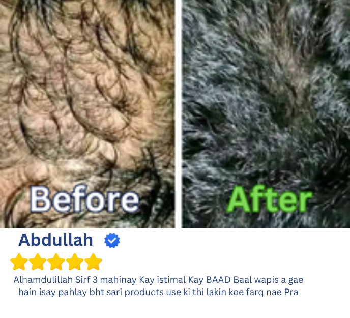 JAMAL UL LISHABAB HAIR GROWTH KIT